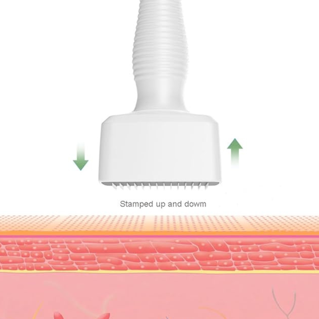 Derma Stamp | Adjustable 0.5 - 3.0 mm